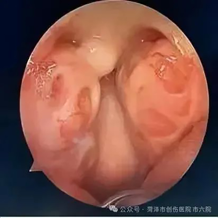 菏泽六院