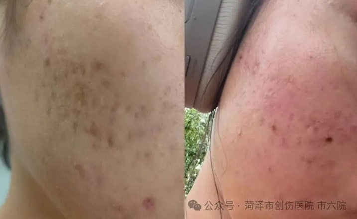 菏泽六院