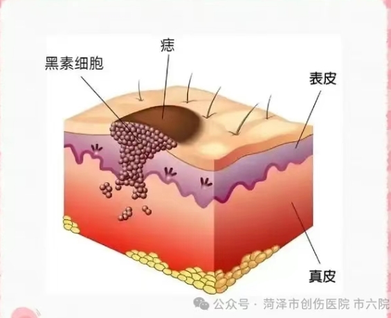 菏泽六院